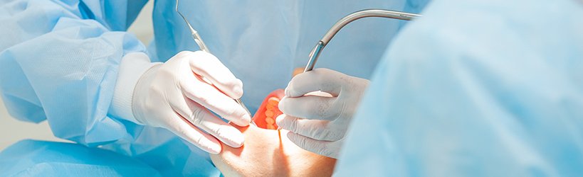 インプラントにかかる各種施術について イメージ