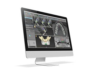 ストローマンガイド イメージ