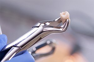 治療の流れ イメージ2