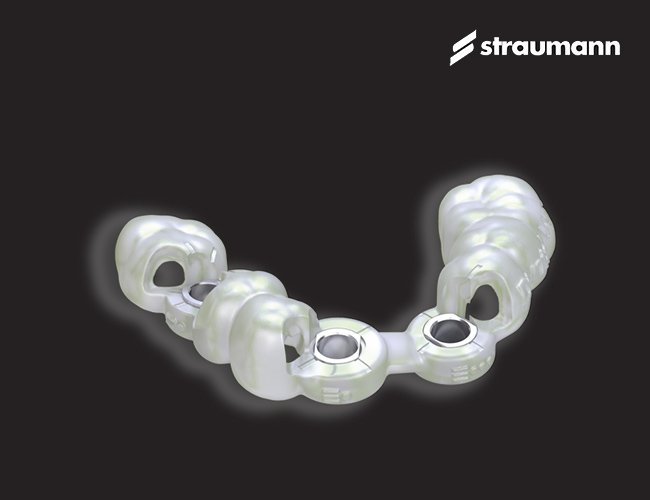 ストローマン・ガイデッド・サージェリー イメージ