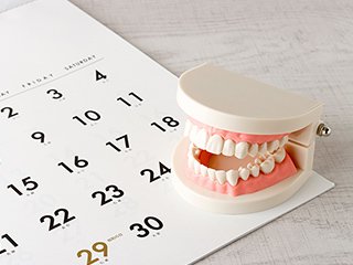 インプラント治療期間について