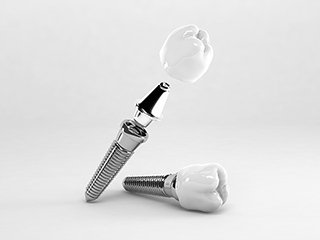 金属アレルギーの方でも安心 イメージ