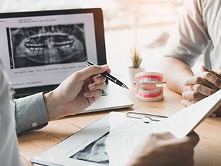 インプラントの保証内容