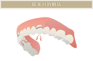 従来の治療法