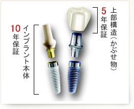 インプラント保証について